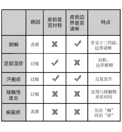 脚上怎样分辨是湿疹还是脚气(脚上怎么分辨是湿疹还是疱疹) 脚上怎样分辨是湿疹还是脚气(脚上怎么分辨是湿疹还是疱疹)